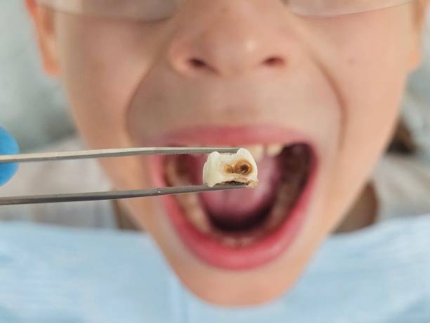 Best Same-Day Emergency Dental Services in New Wilmington, PA